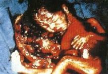 Após PNDH, Aborto poderá ficar impune. Quem se beneficiará?