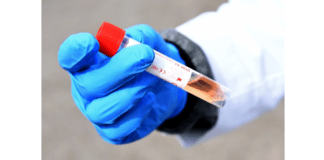 Coronavírus: EUA constata kits de testes chineses contaminados. Uma previsão confirmada