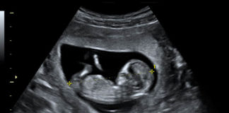 “Quem vos ouve, a mim me ouve”